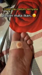 Plester Kutil Mata Ikan Kaki Kapalan Tanpa Efek Samping Plaster Corn Removal