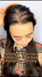 Shampoo Hair Loss Treatment Oil Control Shampoo Rambut Rontok & Menguatkan Akar Rambut 300ml
