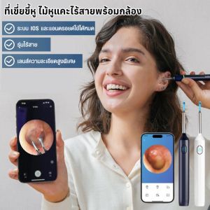 ที่เขี่ยขี้หู ไม้หูแคะไร้สายพร้อมกล้อง ภาพชัดเจนระดับ HD กันน้ำ ไม้จิ้มหู ไม้แคะหูอัจฉริยะ ที่แคะหูกล้อง เครื่องแคะหู ไม้แคะหู ที่แคะหู