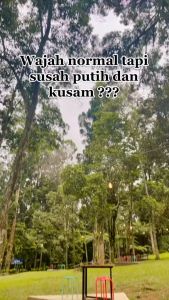 Ms GLow / MS GLOW Whitening Series Original 100% / Ms Glow Whitening / Ms Glow Paket Whitening / Ms glow Paket Normal / Cream Ms Glow / Krim Ms Glow / MSGlow