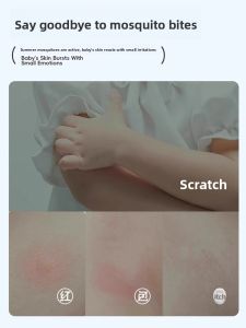 MONLEYTA | Baby Portulaca Oleracea Ointment Portable Cool Relief Itch Stopper Mosquito Bite Prevention And Swelling Relief For Children