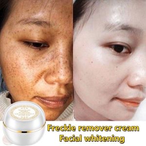 Whitening Cream Moisture Hydra Makeup Base Cream Lady Cream/Lady Fair Cream (30g) siang dan malam putihkan kulit pudarkan jeragat kecilkan pori kawal minyak cerahkan kulit For Dark Skin Spots Snow White Cream 神仙膏 贵妇膏 美白养肤
