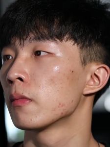 TFIT Concealer Tri-Color Concealer Cover Spots Dark Circles Under Eyes Acne Marks Facial Concealer Palette