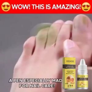 【BUY 2 TAKE 1】EELHOE Nail Repair Essence Serum Fungal Nail Treatment Anti Fungal Nail Solution Hand Foot Skin Care 10ml"