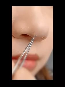 8ชิ้น อุปกรณ์กำจัดสิว ที่กดสิว กำจัดสิวหัวดำ ระบบหนีบสิว เสี้ยนสิว ประหยัดสิว