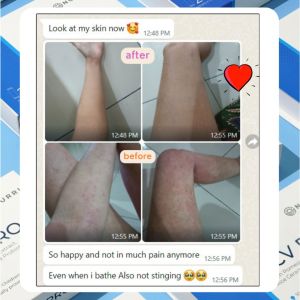 NOURRI - Renewal Blend - (2 Nourri Skin Essence + 1 RCV PRO) for Eczema Psoriasis Dry and Sensitive Skin