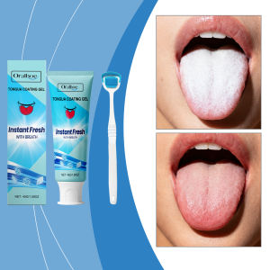 oralhoe | Tongue Refreshing Care Gel Deep Clean Tongue Coating Remove Oral Odor Long Lasting Fresh Breath Daily Oral Hygiene Gel