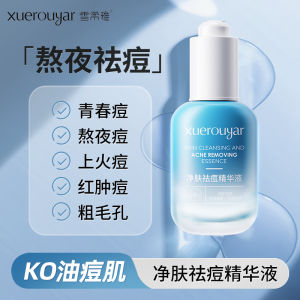 Xuerouyar Gentle Blue Bottle Acne Treatment Essence Liquid Facial Blemish Fading Stable Improvement for Closed Comedones
