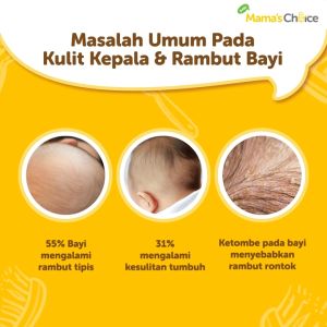 Hair lotion bayi & anak | baby hair vitamin lotion mamas choice - penumbuh rambut (bpom)