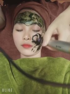 Combo 10 kim nano kim 12 kim 36 chăm sóc da spa