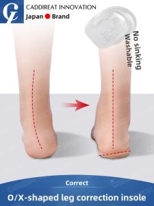 CADDIREAT INNOVATION | Leg Correction Insoles Improve Leg Shape