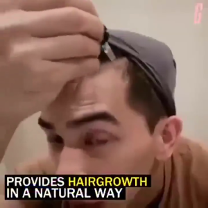 Minoxidil 5% Extra Strength Penumbuh Rambut 100% ORIGINAL Beard Oil Serum Hair Growth Serum Memperbaiki Tekstur Repair Damaged Moisturizing Nutrition Baldness Prevention