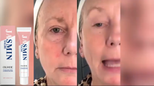 ใต้ตา ครีมนวดรอบดวงตาไฟฟ้า ยกกระชับผิวรอบดวงตา เติมความชุ่มชื้น Rinsran