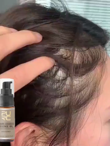 PURC Hair Growth Serum Fast Hair Growth Spray Hair & Scalp Treatments Anti Hair Loss 30ml Hair Grower for Man/Woman Hair Growth Hair Fall Treatment