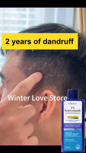 Original 1% Ketoconazole Psoriasis Shampoo For Scalp Anti-Loss Hair Growth Relieves Itchy Scalp Oil-Control And Anti-Dandruff Shampoo For Refreshing And Fluffy Hair Suitable For Men And Women 265g