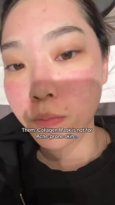 Anua Heartleaf 70 Soothing Collagen Mask (4ea)