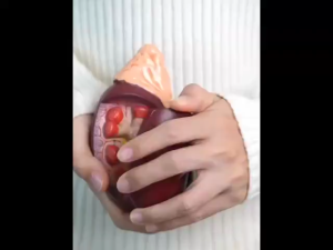 Madugin Madu Herbal Solusi Gagal Ginjal Batu Ginjal Dan Kronis 250 ml Asli Original