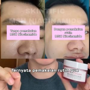 SKINTIFIC MSH Niacinamide Brightening Moisturizer Glowing Moisture Gel 30g
