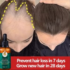 Esensi Pertumbuhan Serum Rambut & Minyak Rambut 30ml