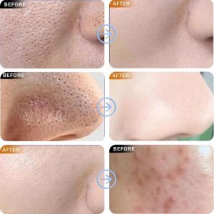 kecilkan pori muka mud maskavocado bubble mask blackhead removal clean pores pore minimizer hilangkan blackhead oil control white  12pcs/box牛油果泡泡面膜