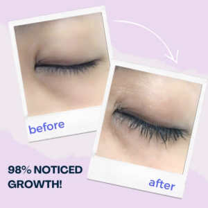 [XLASH] Eyelash Growth Serum Oil Free Vegan