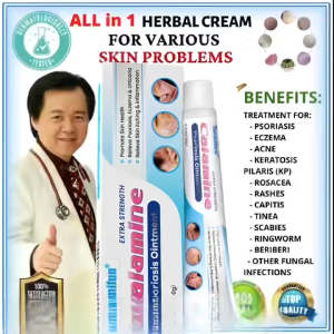 【Shipment within 24 hours】Calamine Eczema Cream For Treating Psoriasis And ointment for skin allergy Mosquito Bites itch cream