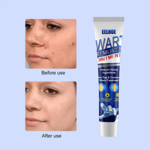 Warts Remover Original Skin Tags Mole Remover Corn Plantar Wart Cream Wart Removal Ointment 20g
