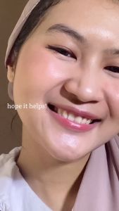 Lacoco Intensive Treatment Eye Serum: Solusi Mata Panda & Kantung Mata