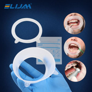 ELIJAH Dental Rubber Mouth Opener O Shape Expander Cheek Retractors Orthodontic Oral Rubber Dam Retractor Teeth Whitening Tool