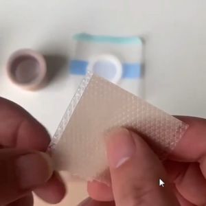 scar patch hilangkan parut keloid silicone scar sheet Hilangkan parut lama Parut kaki scar removal Stretch Marks