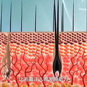 sampo anti ketombe dan gatal  Jual Shampo Jahe 500ml shampoo rambut romtok /Menutrisi kulit kepala/Rambut lembut dan halus