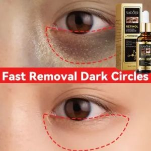 SADOER Retinol Wrinkles Dark Eyebag Removal /Anti-Aging Moisturizing Lingkaran Hitam Pelembab Wajah Anti-Penuaan Serum  30ml