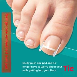 A Comprehensive Guide to Long Correction Nail Tools & Nail Groove Handy Gadgets