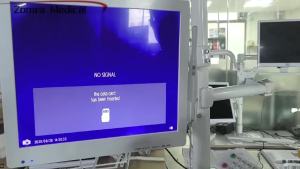Portable Dental Intra-oral Camera High Resolution for Oral Examination with AV TV Connection