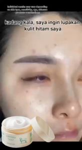 Krim Wajah Susu Kambing: Solusi Flek & Melembapkan