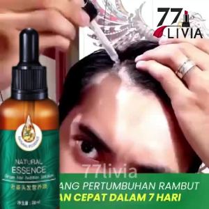 Esensi pertumbuhan serum rambut/minyak rambut 30ml meningkatkan pertumbuhan rambut/anti-rambut rontok/agen penumbuh rambut/kondisioner rambut/esensi pertumbuhan rambut jahe untuk perawatan rambut kering rusak dan pertumbuhan rambut
