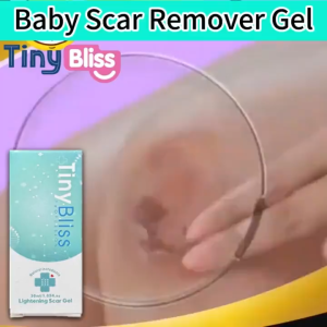 .. Tiny Bliss Baby Lightening Scar Gel 30ML Baby Scar Remover Cream For Kids Scar peklat remover .