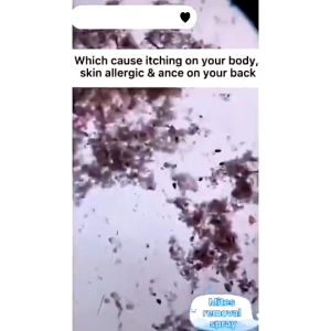 Mite Spray Insect Spray Bed Bug Killer Mite Killer Health Non-toxic Natural Removal