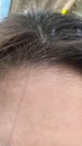 Alat Pencabut Bulu Halus Wajah Spring Facial Epilator Alat Penghilang Bulu Bibir Hidung Portable