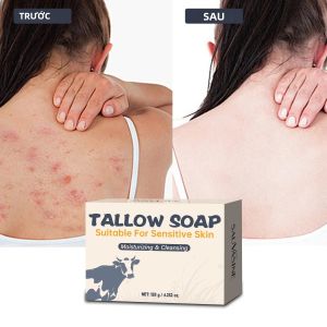 Xà Phòng Mỡ Bò Tự Nhiên 120g Dùng Cho Mặt & Toàn Thân - Làm Sạch Dưỡng Ẩm & Làm Mịn Da Xà Phòng Thủ Công Phù Hợp Với Da Nhạy Cảm