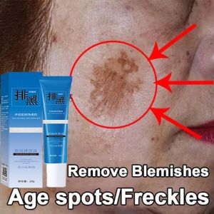 14 Days Freckle Removal Cream Whitening Dark Spot And Pigmentation Remover Cream 祛斑霜 Melasma Remove Cream For Face Black Spot Removal Brightening Skin Care 20g