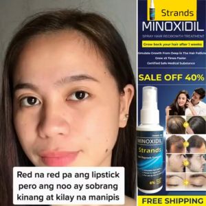 TRENDING HAIR SOLUTION Minoxidil Strands 6% Minoxidil Topical Solution (60ml per bottle) Hair Grower Beard Grower Treatment for Thinning Hair Split Ends Dryness Volumizing Hair Grower Dandruff Frizziness Hairloss Damage Hair.