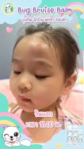 Lynn Organic Bug Bruise Balm