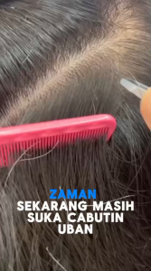 [𝐎𝐑𝐈𝐆𝐈𝐍𝐀𝐋] Shampoo Uban Menjadi Hitam / Shampoo Uban Permanen Black Herbal Natural Polygonum Multiflorum Hair Blackening - 300ml