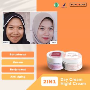 Paket 2in1 Krim Wajah Yonglow Skincare: Solusi Penghilang Beruntusan & Pemutih Kulit