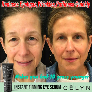 celyn firming eye cream for wrinkles eyebag eyebags remover original eye cream for dark under eye papa peel eye cream anti aging eyebag remover for men magic eye balm cooling stick[ Delays aging wrinkles remover eye tighten cream ] 30ml