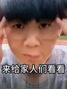 Selenium Sulfide Anti-Dandruff Shampoo Itchy Scalp Control Oil 二硫化硒去屑洗发水 止痒控油防脱洗头水 清爽蓬松 改善毛囊炎