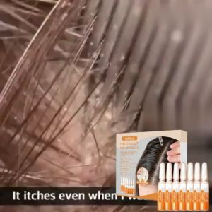 EELHOE Rosemary Hair Ampoules Anti-Hair Loss Penipisan Rambut Serum Hair Regrowth Serum