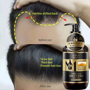 Hair growth shampoo Anti Hair loss shampoo 400ml Anti Hair Loss Promote Thick Hair Growth Reduce Hair Fall Oil Control Anti dandruff Hair growth shampoo