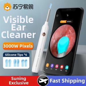 Smart Visual Ear Spoon High Definition Lighted Ear Cleaning Tool with Lamp Childrens Ear Digging Gadgets Non-Disposable